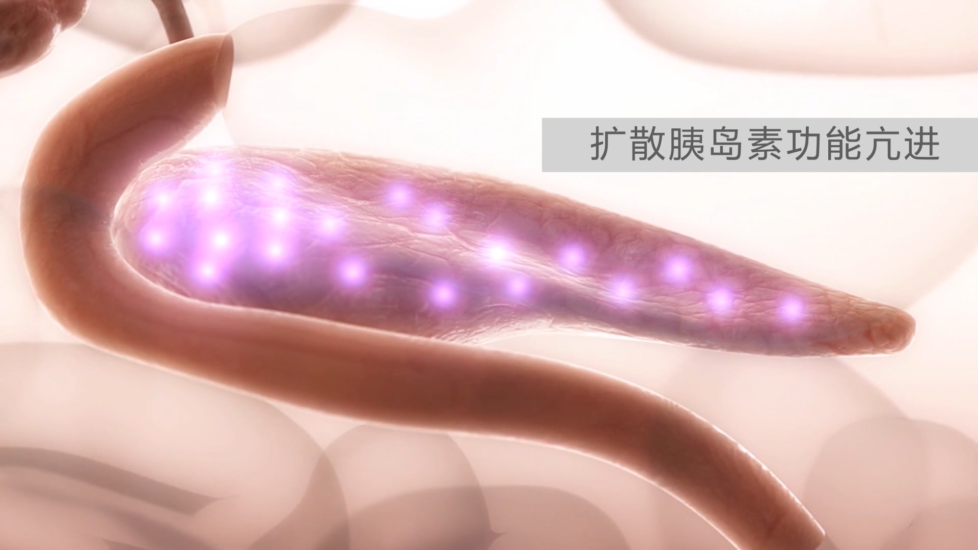 幼儿糖尿病发病机理