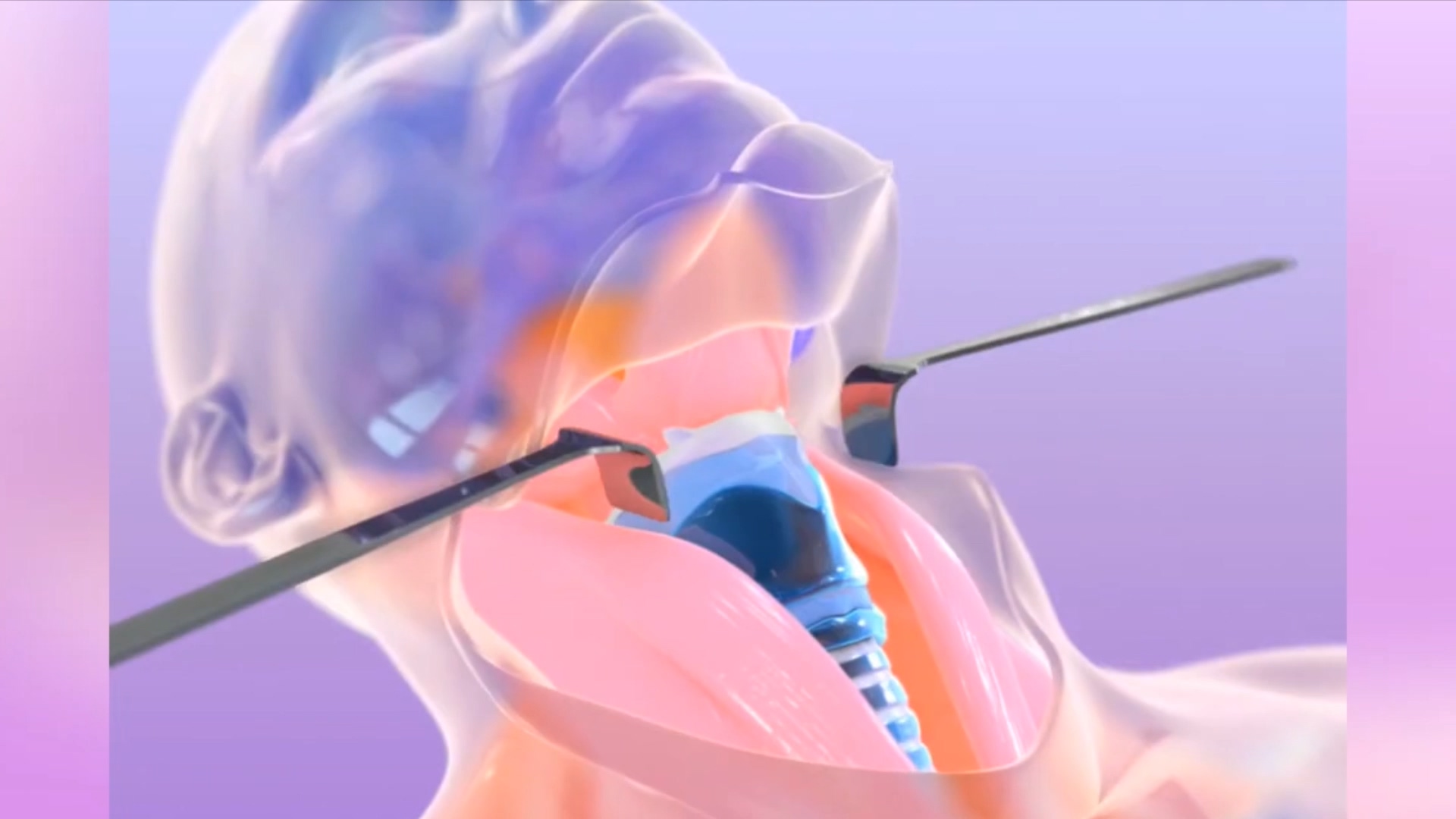 样本检测设备-医疗动画