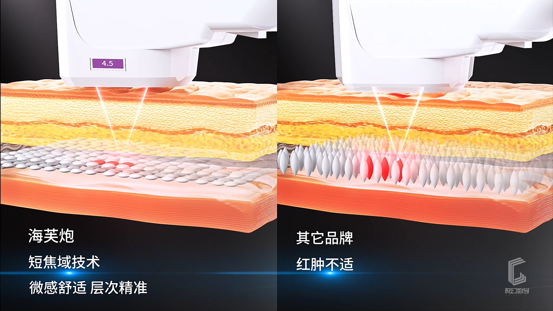 美容仪器超声炮三维产品宣传视频